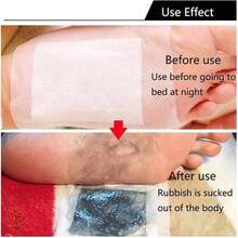 100pcs Natural Mugwort Foot Patches Deep Cleansing Foot Care - Two-piece set - View 5