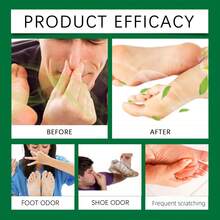 JUE FISH 2pcs Shoe Deodorizer Capsules 1pc/100g Cleaning Powder, Essential For Sports Enthusiasts, Sweaty Feet, And People Who Wear Shoes For Long Periods, Put In Long-Term Stored Shoes, Seasonal Storage Boots To Prevent Moisture And Odor, Travel And Business Trip Portable, Easily Solve Shoe Odor Problems, Not Just For Shoes, Shoe Cabinets, Shoe Boxes, Travel Shoe Bags Can Also Be Used, All-Season Essential Gift - Powdery - View 2