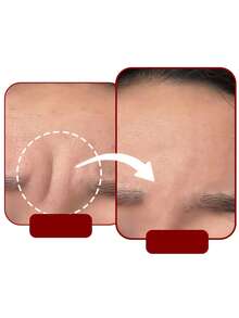 12/1pc Self-Adhesive Sleep Forehead Patches - Reusable Facial Elastic Strips, Full-Face Training Patches, Washable And Reusable Adhesive - Multicolor - View 6