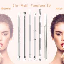 6pcs Acne Squeezing Tool Set, Blackhead Removal Acne Needle Tool Kit, Closed Comedones Whitehead Pimple Extractor Treatment, Suitable For Nose And Facial Skin Flaw Extraction - Silver - Silver - View 2