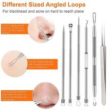 6pcs Acne Squeezing Tool Set, Blackhead Removal Acne Needle Tool Kit, Closed Comedones Whitehead Pimple Extractor Treatment, Suitable For Nose And Facial Skin Flaw Extraction - Silver - Silver - View 6