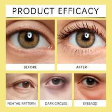 Hoygi Firming Eye Contour Cream With Bee Venom, Eliminates Dark Circles, Reduces Bags Under The Eyes, Brightens, Reduces Puffiness, Improves Skin Elasticity, Relaxes And Provides Long-Lasting Hydration For The Eye Contour. - Crema reafirmante para el contorno de ojos con veneno de abeja - 查看 9