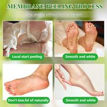 5 Pares Máscara de Descascamento de Pés com Jojoba & Aloe Vera - Máscara Esfoliante para os Pés, Hidratante & Nutritiva com Ácido Lático, Ureia & Ácido Málico para Pés Ásperos & Secos, Máscara para os Pés para Remoção de Pele Morta, Cuidados com os Pés, Produto Hidratante para os Pés & SPA - Visão 3