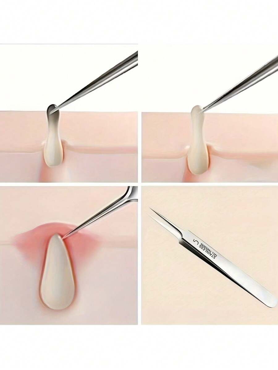 1/2/3pcs Ultra-Fine Point Tweezers, High-Quality Stainless Steel Material, Suitable For Nose And Face, Ideal Choice For Blackhead And Pore Cleaning, Hair Removal - Multicolor - View 1