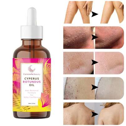 Aceite Natural para la Eliminación del Vello & Inhibidor de Crecimiento del Vello Corporal Cyperus Rotundus para Mujeres & Hombres, Calma la Piel, 60ml, Todos los Tipos de Piel