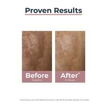 Eucerin سيروم وعلاج الوجه - فيتامين سي - مشاهدة 7