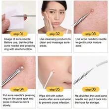 1/4 Set Stainless Steel Black Acne Removal Tools, Pimple Extractor, Quickly And Easily Clear Acne, Forehead, Face And Nose Cleaning Tools, 2-In-1 Stainless Steel Acne Removal Tool, Unisex, Practical Acne Removal Tool - Silver - View 8