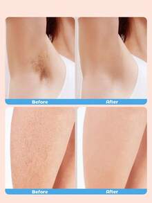 COTTONHK Electric Razor For Women, Wet/Dry Rotary Electric Shaver, Rechargeable Hair Removal Device Epilator, Portable Hair Trimmer For All Skin, Bikini, Arms - White - View 3