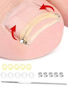 16pcs/Set Toe Ingrown Nail Ring Stretch Rebound Nail Groove Rolled Nail Physical Reverse Stretch Tool Painless Improvement Of Ingrown Nails Relief Of Paronychia Pain Ingrown Nail Tool Suitable For Men And Women Daily Foot Care Exquisite Gift - Multicolor - View 3