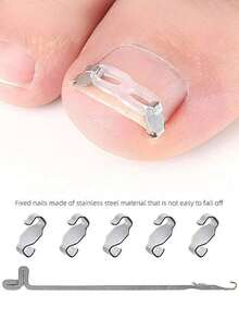 12pcs Ingrown Toenail Correction Kit, Nail Correction Clips, Ingrown Toenail, Curved , Toenail Traction Correction Patches, Nail Clips, Foot Care Tools, Reusable - Multicolor - View 5