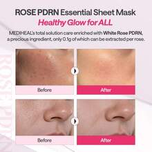 MEDIHEAL - Rose PDRN Essential Mask Sheet For Healthy Glow 10Pcs - Rose PDRN - 查看 3