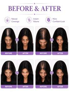 Women' 25.4 Cm Human Hair Wig Toppers With Hairpieces For Women To Cover Gray Hair, Adding Volume With A Lightweight And Seamless Design, Featuring A Middle Part, Hair Addition For Thinning Hair Natural Black #1B & Dark Brown #2 - Multicolor - View 8