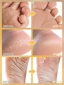 5 Pasang Masker Kaki Eksfoliasi untuk Kulit Kaki Kering, Pengangkat Kulit Mati, Masker Pengelupas Kaki, Mengencangkan, Hipoalergenik, untuk Menghaluskan, Melembapkan Kaki, Mengembalikan Kekencangan Kulit, Masker Kaki Lembut dan Halus - View 4
