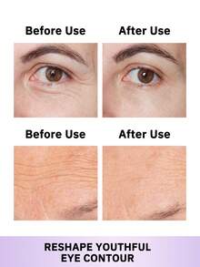 L'Oreal L'Oréal Revitalift Filler Eye Cream With Hyaluronic Acid + Pro-Xylane-30ml - 30毫升 - 查看 8