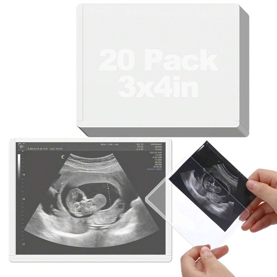 Easy Insert Photo Protector For 3x4in Pictures - Side-Loading To Keep Baby Picture/Special Memories , Pregnancy Journal Must Haves, Pregnancy Gifts For Expecting Mom, - Horizontal - View 1