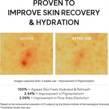 Arencia - PDRN Booster Shot 30ML - PDRN Booster - PDRN - 查看 4