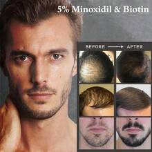 Ruahouine Hair  Treatment For Thicker Longer, 5% Minoxidil Biotin Hair Serum Oil For Men And Women, Prevents Hair Loss And Thinning, 2.11 Fl.Oz - default - View 7