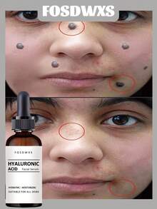 Hyaluronic Acid Facial Serum | Deep Hydration & Moisture Lock, Suitable For All Skin Types, Nourishes Silky & Radiant Skin Texture - Multicolor - View 1