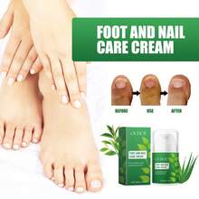 Crema para el Cuidado de Uñas de Pies OUHOE, Hidratante y Nutritiva para Manos y Pies, Repara Onicomicosis y Pies Agrietados. IILD - 1 - Ver 3