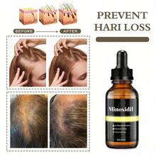 Ruahouine Hair  Treatment For Thicker Longer, 5% Minoxidil Biotin Hair Serum Oil For Men And Women, Prevents Hair Loss And Thinning, 2.11 Fl.Oz - default - View 2
