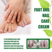Crema para el Cuidado de Uñas de Pies OUHOE, Hidratante y Nutritiva para Manos y Pies, Repara Onicomicosis y Pies Agrietados. IILD - 1 - Ver 4