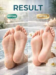 2pcs Professional Foot Care Set, 4-Sided Pumice Foot Scrub Brush & Stainless Steel Foot Scraper, Dead Skin & Callus Removal Foot Beauty Tool Set, Home Foot SPA - Multicolor - View 3