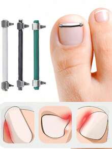 1pc Premium Stainless Steel Ingrown Toenail Tool, Suitable For Men And Women Daily Foot Care, Exquisite Gift, Portable Ingrown Toenail Tool For Men And Women - Multicolor - View 3