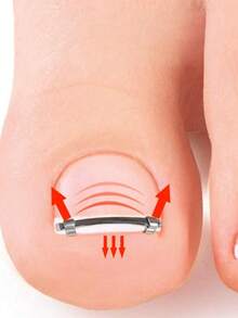 1pc Premium Stainless Steel Ingrown Toenail Tool, Suitable For Men And Women Daily Foot Care, Exquisite Gift, Portable Ingrown Toenail Tool For Men And Women - Multicolor - View 5