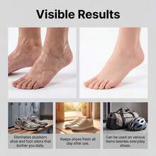 Shoe Deodorizing Spray, Odor And Smell Cleaning, Gentle Formula, Portable Daily Deodorizing Spray - A - View 3