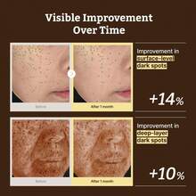 Serum HPR 視黃醇面部精華液 抗老細緻毛孔 新一代韓系護膚品 溫和適用初學者 - 多色 - 查看 6