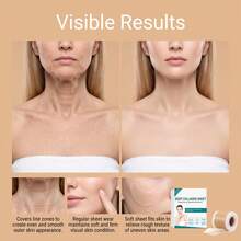 1 pièce Rouleau de bande de silicone de qualité médicale, feuille de silicone réutilisable de la couleur de la peau pour les cicatrices chirurgicales, la césarienne, l'acné, les chéloïdes, les vergetures, patch de retrait de cicatrice adhésif doux et imperméable, bandes de traitement de cicatrice longue durée - Multicolore - Voir 11