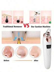 Rechargeable Blackhead Remover, 400mAh Lithium Battery, Multi-Functional Facial Care Tool For Skin Cleansing - White - View 5