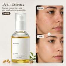 Serums & Facial Treatment - 1PCS - View 1