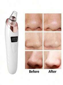 Rechargeable Blackhead Remover, 400mAh Lithium Battery, Multi-Functional Facial Care Tool For Skin Cleansing - White - View 3