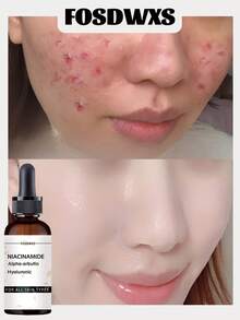 烟酰胺+α-熊果苷+透明质酸，适合所有肤质 - 彩色 - 查看 1