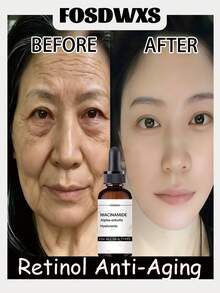 烟酰胺+α-熊果苷+透明质酸，适合所有肤质 - 彩色 - 查看 6
