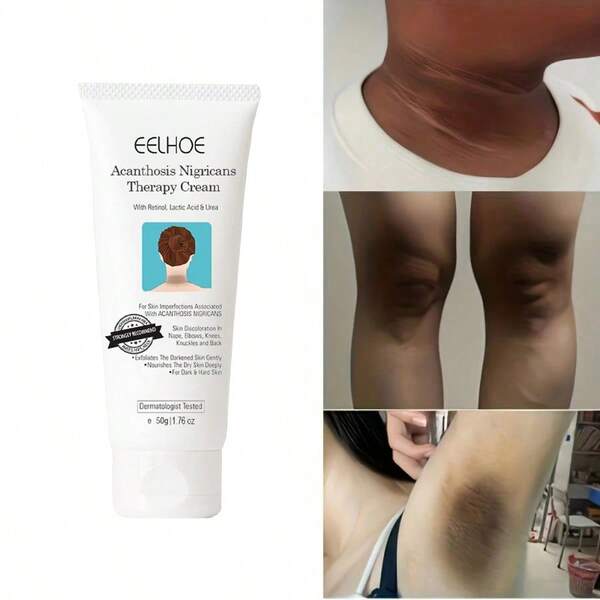 Black Spine Skin Care Cream, Moisturizing And Nourishing For Delicate Arms And Knees, Refreshing Skin And Body Care