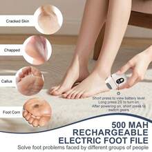 1 USB Charging Electric Foot Grinder, Three Replaceable Grinding Heads, 3-Speed, Used To Remove Cracked Heels And Calluses - Thick Faux Leather Polishing, Portable And Easy To Use, USB Charging, Suitable For Hand And Foot Care - Multicolor - View 9