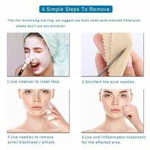 Set de 4 piezas de agujas para eliminar puntos negros y acné, herramienta de limpieza de poros faciales, removedor de puntos negros, producto de belleza, cuidado de la piel, spa, autocuidado, herramienta de cuidado de la piel, cuidado facial, suministros de esteticista, piel, limpiador, cuidado facial - Multicolor - Ver 5