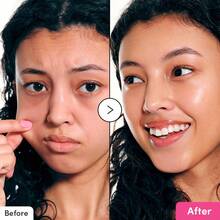 Madeca 積雪草面霜,適合乾燥與敏感肌膚。成分:TECA、積雪草、積雪草苷 - 乳霜 - 查看 3