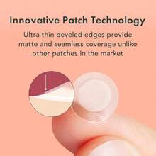 Pimple Patches, Korean Skin Care, 2 Sizes (108 Count) - 108 Count / Set - View 3