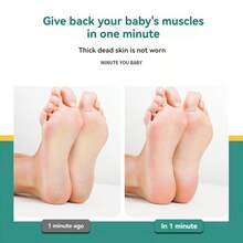 PYDESA 2pcs/4pcs/6pcs 2-In-1 Foot File Dead Skin Removal Set, Double-Sided Stainless Steel Foot Scraper Callus Remover, Washable Foot Care Tool, Suitable For Hard Skin, Cracked Heels, Dry Skin Exfoliation - Multicolor - View 7