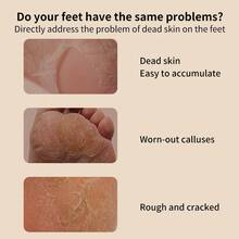 SOKANY Electric Foot Callus Remover, Electric Foot Exfoliator, Removes Dead Skin And Calluses, 2-Speed Adjustable, Type-C Rechargeable (500mAh Lithium Battery), Replaceable Grinding Heads, Washable, Essential For Home And Travel - Multicolor - View 6