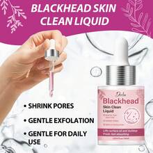 Blackhead Skin Cleansing Serum 30ml, Fast Absorption, Softens Skin, Exfoliates, Removes Blackheads, Shrinks Pores, Revitalizes Skin & Controls Oil - Blackhead Removal - View 1