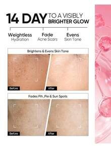 SKINTIFIC SKIINTIFIC Niacinamide Brightening Cream, Fades Dark Spots, Evens Skin Tone, Contains Kojic Acid, α-Arbutin, 5x Ceramide, Centella Asiatica Extract, Suitable For Oily And Acne-Prone Skin, 2.82 Oz/80g - Niacinamide - View 10