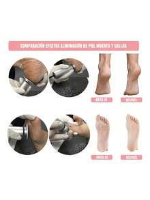 Electric Foot Files - 灰色 - 查看 3