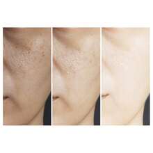 JAYSUING Cleansers - Deep Cleansing - View 4