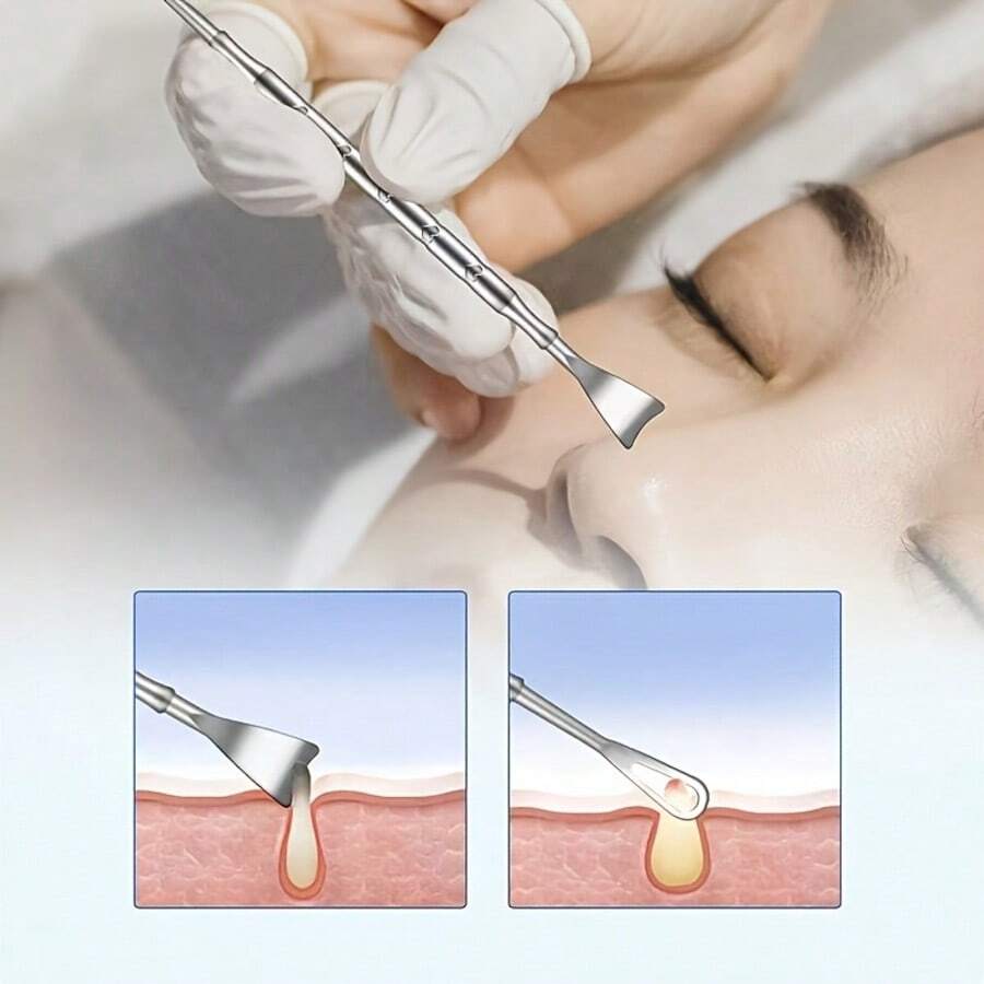 Double Headed Blackhead Removal Tool Suitable For All Light Beige Skin, A Nose Hair Cleaner, Portable Skincare Accessory, Ergonomic Handle, No Need For Electricity - Silver - View 1