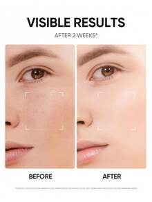 SKINTIFIC SKIINTIFIC Niacinamide Brightening Cream, Fades Dark Spots, Evens Skin Tone, Contains Kojic Acid, α-Arbutin, 5x Ceramide, Centella Asiatica Extract, Suitable For Oily And Acne-Prone Skin, 2.82 Oz/80g - Niacinamide - View 5