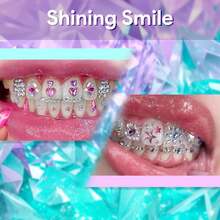 28pcs/1set Cute Colorful Butterfly Tooth Inlay Set, Faux Rhinestone Tooth Fashion Inlay, DIY Tooth Beginner Jewelry, Suitable For Men And Women (Glue Not Included) - 28PC Multi-color Set - View 6